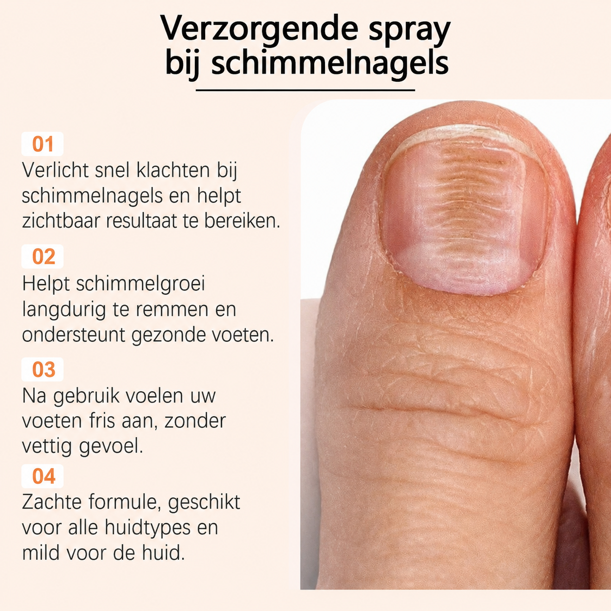 NailCure™ | Voor Gezonde, Schone En Perfect Verzorgde Nagels | 1+1 GRATIS