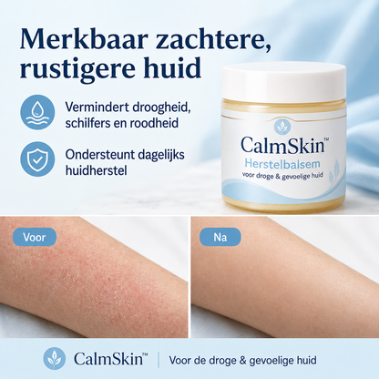 CalmSkin™ | Intensieve herstelbalsem bij droogheid, roodheid en schilfers