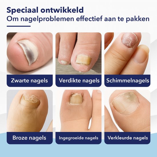 CuraNail™ | Herstelt Uw Nagels Terwijl U Slaapt | 1+1 gratis (42 pleisters)