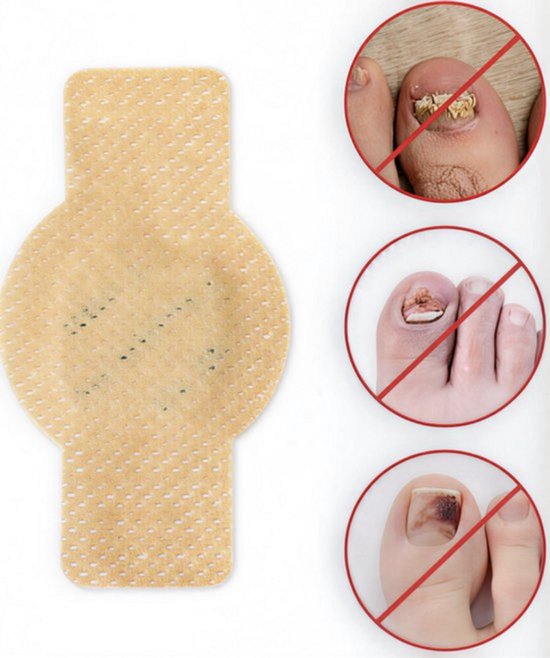 CuraNail™ | Herstelt Uw Nagels Terwijl U Slaapt | 1+1 gratis (42 pleisters)