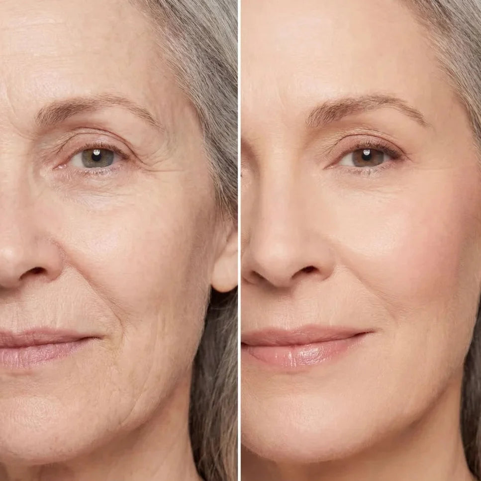 EyeLift™ | Laat wallen verdwijnen & strijk rimpeltjes glad in enkele minuten | 1+1 gratis