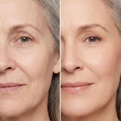 EyeLift™ | Laat wallen verdwijnen & strijk rimpeltjes glad in enkele minuten | 1+1 gratis