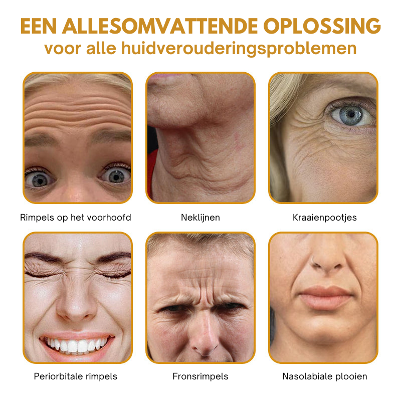 Anti-Wrinkle™ | Botox Rimpelverwijdering Crème | 1+1 gratis
