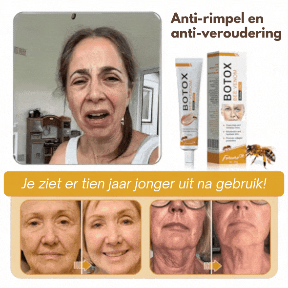 Anti-Wrinkle™ | Botox Rimpelverwijdering Crème | 1+1 gratis