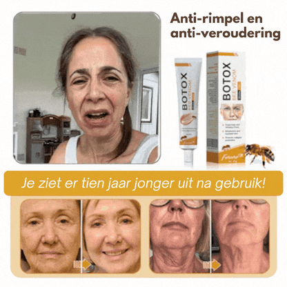 Anti-Wrinkle™ | Botox Rimpelverwijdering Crème | 1+1 gratis