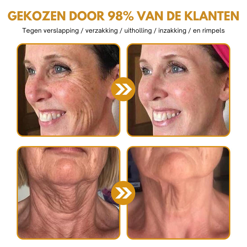 Anti-Wrinkle™ | Botox Rimpelverwijdering Crème | 1+1 gratis