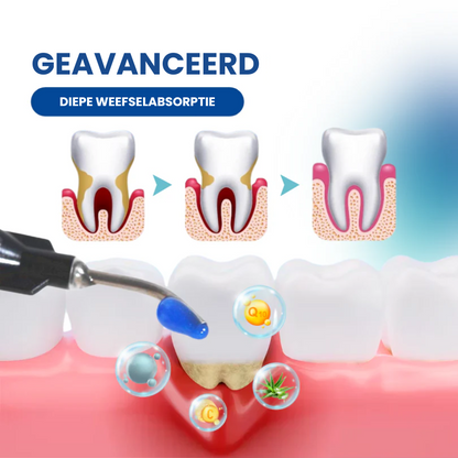 GumRestore™ | Pakt terugtrekking, pijn en irritatie tegelijk aan | 1+1 gratis