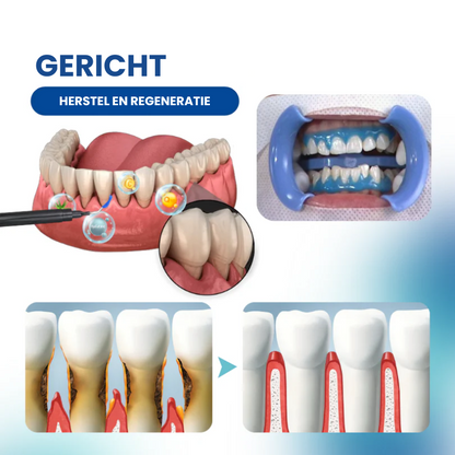 GumRestore™ | Pakt terugtrekking, pijn en irritatie tegelijk aan | 1+1 gratis