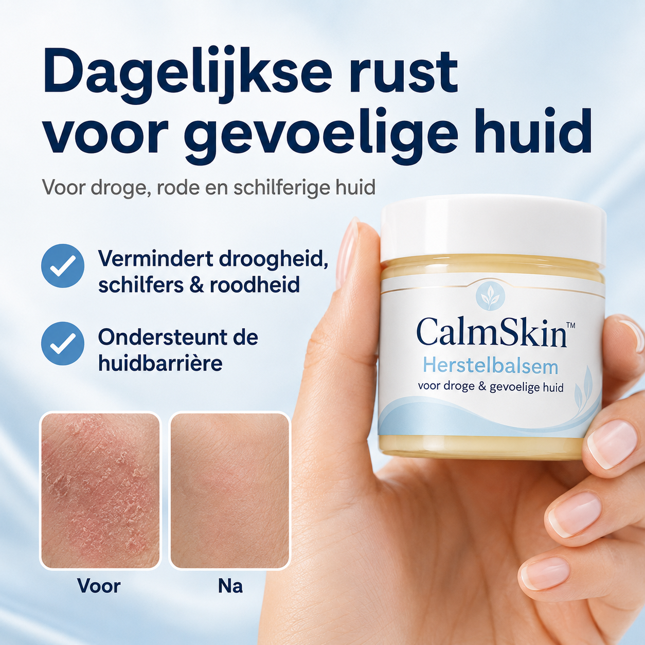 CalmSkin™ | Intensieve herstelbalsem bij droogheid, roodheid en schilfers