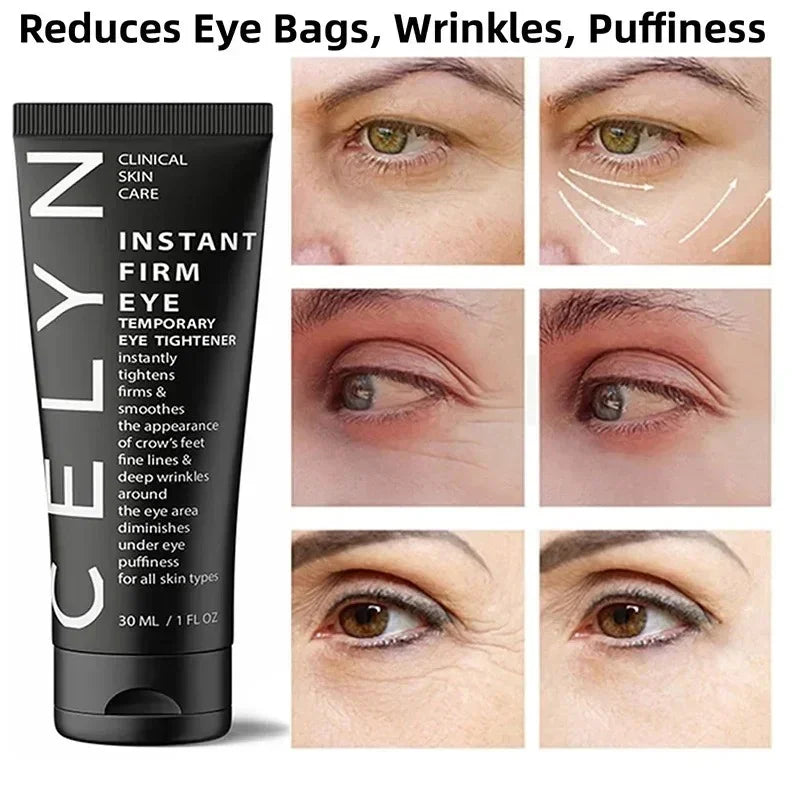 Cëlyn™ Instant EyeReviver - Lumingo