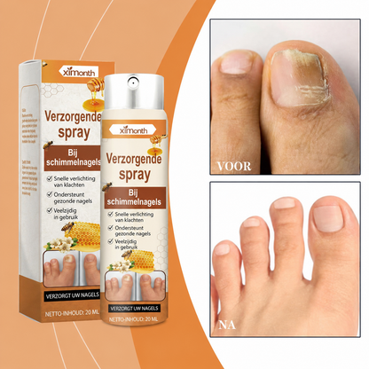 NailCure™ | Voor Gezonde, Schone En Perfect Verzorgde Nagels | 1+1 GRATIS